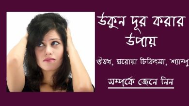 Photo of উকুন দূর করার উপায় ঔষধ