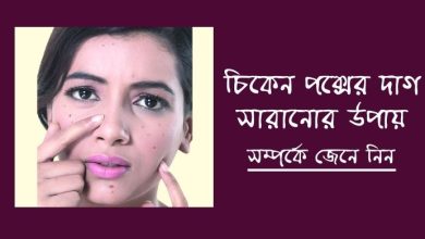 Photo of চিকেন পক্সের দাগ সারানোর উপায়